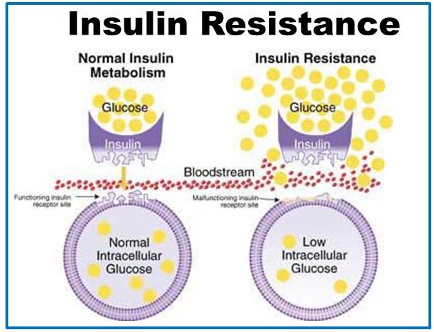 Insulin-Resistance-1